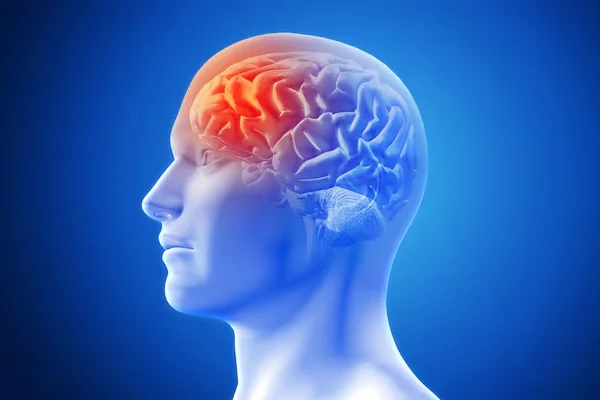 Hydrocephalus Treatment